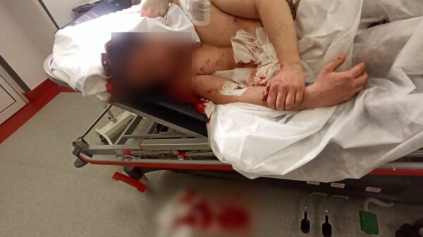 Mężczyzna zaatakował w Opolu siekierą ratownika medycznego. Poszkodowany z obrażeniami trafił do szpitala.