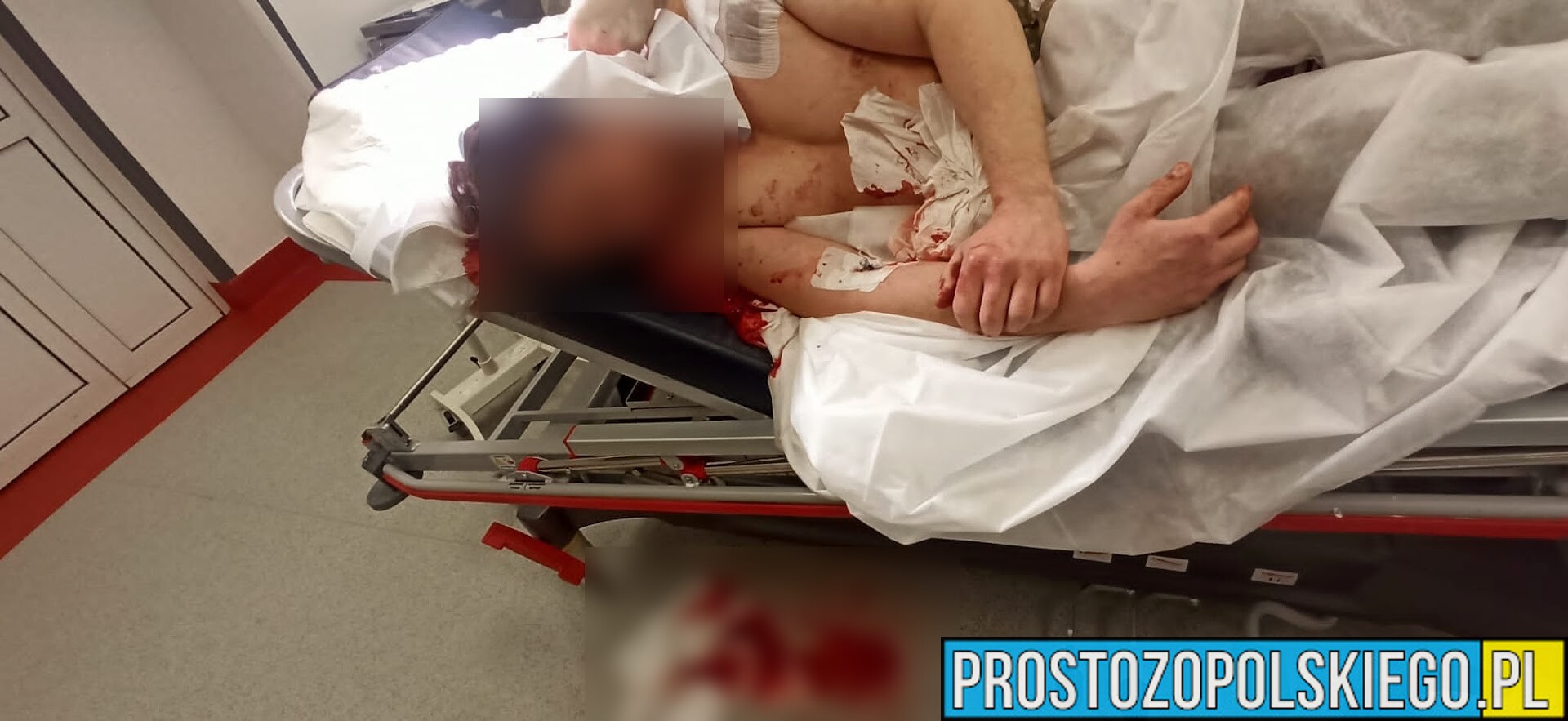 Mężczyzna zaatakował w Opolu siekierą ratownika medycznego. Poszkodowany z obrażeniami trafił do szpitala.