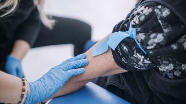 Badanie witaminy D w cenie 35 zł